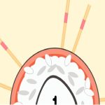 PinPoint